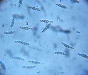 Winziger Kernpilz, Foto 8