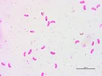Ziegelroter Rindenpilz, Foto 13