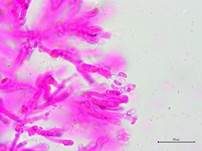 Ziegelroter Rindenpilz, Foto 14