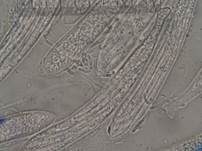 Zierliches Lärchenzapfen-Spinnwebbecherchen, Foto 31