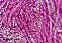Anemonenbecherling, Foto 42