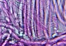 Anemonenbecherling, Foto 43
