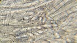 Anemonenbecherling, Foto 45