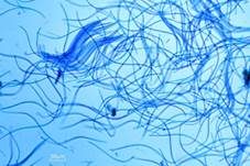Zuckerwatte-Wasserpilz, Foto 7