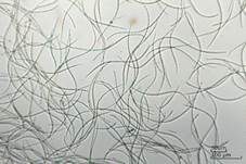 Zuckerwatte-Wasserpilz, Foto 9