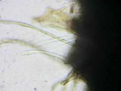 Zugespitzter Schlangenwerferkugelpilz, Foto 3