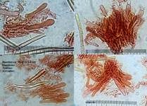 Braunfilziger Schichtpilz, Foto 19