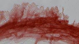 Bräunlicher Rindenhelmling, Foto 8