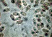 Dickstacheliger Zähnchenrindenpilz, Foto 16