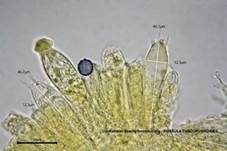 Dunkelroter Stachelbeertäubling, Foto 39