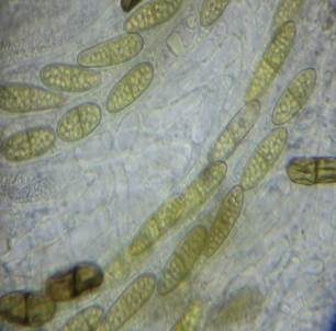 Ellipsenspor-Kernpilz, Foto 4
