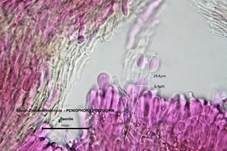 Espen-Zystidenrindenpilz, Foto 24