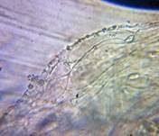 Farn-Helmling, Foto 21