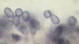 Feinwarziger Flockenschwamm, Foto 5
