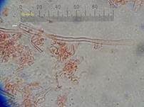 Feinzahniger Rindenpilz, Foto 14