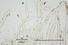 Feuerfarbiger Saumpilz, Foto 22