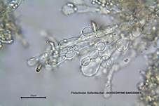 Fleischroter Gallertbecher, Foto 51
