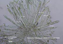 Fleischroter Gallertbecher, Foto 55