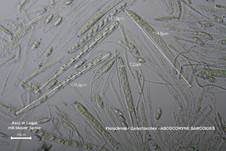 Fleischroter Gallertbecher, Foto 57