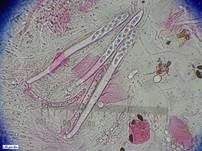 Fleischroter Gallertbecher, Foto 63