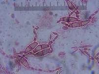 Fleischroter Gallertbecher, Foto 65