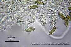 Flockenstieliger Hexenröhrling, Foto 75