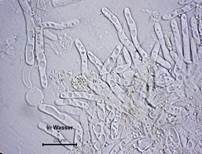 Blasser Adermoosling, Foto 20
