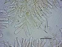 Blasser Adermoosling, Foto 25