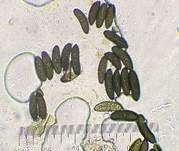 Subiculum-Schwarzbrust, Foto 15