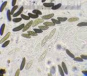 Subiculum-Schwarzbrust, Foto 11