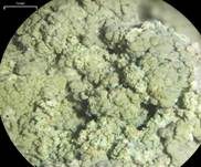 Braune Köpfchenflechte, Foto 9