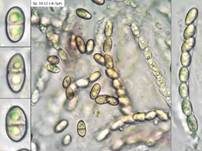 Aufsitzender Pustelpilz = Anamorphe oder Nebenfruchtform oder auch, Foto 14